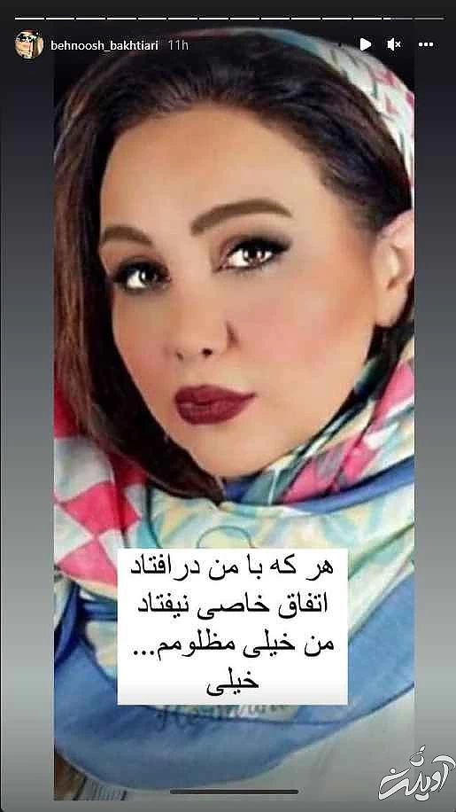 این خانم بازیگر رکورددار جراحی زیبایی ایرانی ! + تصاویری افشاگر !